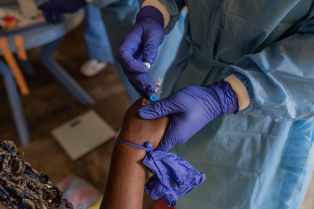 Kenya receives 10,700 doses of mpox vaccine
