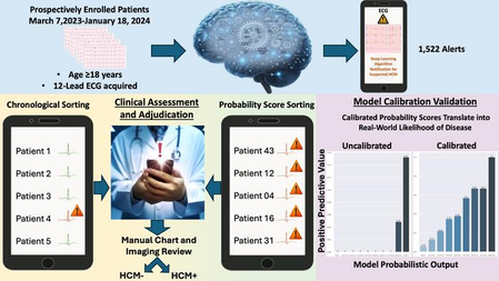AI algorithm can help identify high-risk heart patients: Study